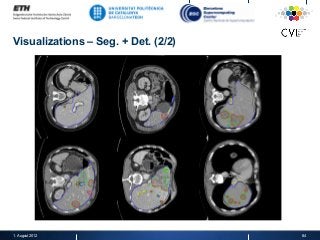 Visualizations – Seg. + Det. (2/2)
1. August 2012 84
 