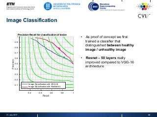 Image Classification
0.2 0.4 0.6 0.8 1
Recall
0.1
0.2
0.3
0.4
0.5
0.6
0.7
0.8
0.9
1
Precision
Precision-Recall for classification of lesion
Image Classification with VGG-16
Image Classification with ResNet-50
31. July 2017 86
•  As proof of concept we first
trained a classifier that
distinguished between healthy
image / unhealthy image
•  Resnet – 50 layers really
improved compared to VGG-16
architecture
 