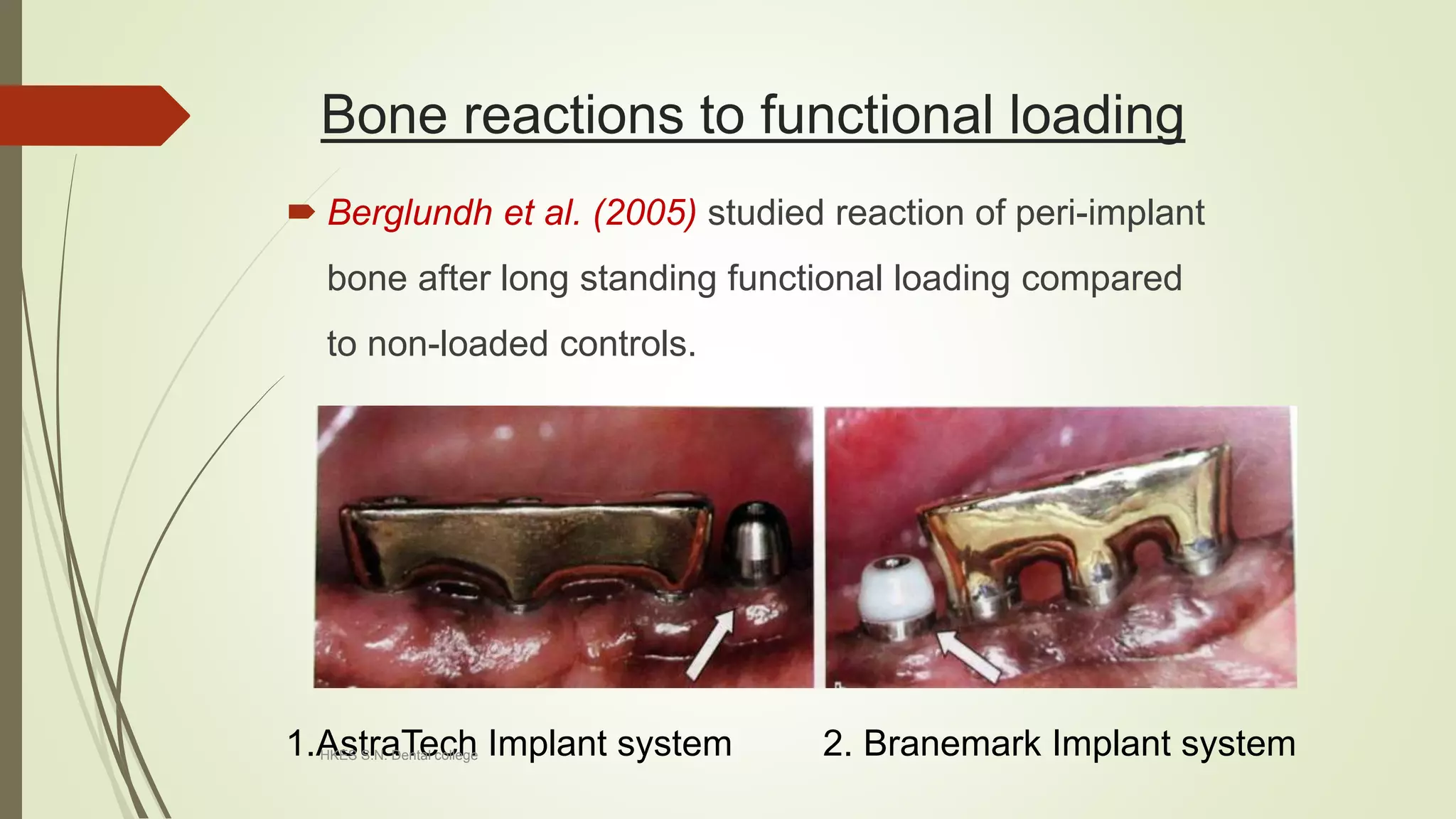 Trauma from occlusion (Including TFO around dental implants) | PPTX