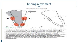 Tipping movement
26
 
