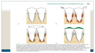 Jiggling type of trauma
30
 