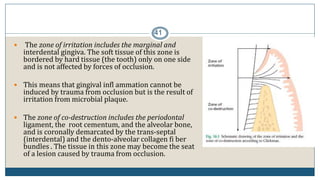 41
 The zone of irritation includes the marginal and
interdental gingiva. The soft tissue of this zone is
bordered by hard tissue (the tooth) only on one side
and is not affected by forces of occlusion.
 This means that gingival infl ammation cannot be
induced by trauma from occlusion but is the result of
irritation from microbial plaque.
 The zone of co-destruction includes the periodontal
ligament, the root cementum, and the alveolar bone,
and is coronally demarcated by the trans-septal
(interdental) and the dento-alveolar collagen fi ber
bundles . The tissue in this zone may become the seat
of a lesion caused by trauma from occlusion.
 