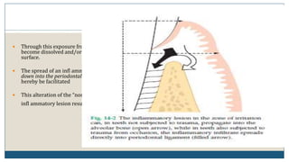 42
 Through this exposure from two different directions the fiber bundles may
become dissolved and/or orientated in a direction parallel to the root
surface.
 The spread of an infl ammatory lesion from the zone of irritation directly
down into the periodontal ligament (i.e. not via the interdental bone) may
hereby be facilitated
 This alteration of the “normal” pathway of spread of the plaque-associated
infl ammatory lesion results in the development of angular bony defects.
 