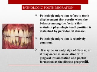 Trauma from occlusion- Perio ANKITA.pptx