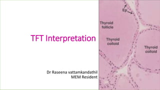 TFT Interpretation
Dr Raseena vattamkandathil
MEM Resident
 