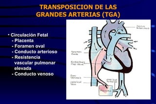 TRANSPOSICION DE LAS GRANDES ARTERIAS (TGA) Circulación Fetal - Placenta - Foramen oval - Conducto arterioso - Resistencia  vascular pulmonar elevada - Conducto venoso 