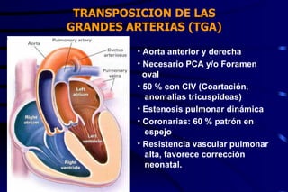 TRANSPOSICION DE LAS GRANDES ARTERIAS (TGA) Aorta anterior y derecha Necesario PCA y/o Foramen oval 50 % con CIV (Coartación,  anomalías tricuspideas) Estenosis pulmonar dinámica Coronarias: 60 % patrón en espejo Resistencia vascular pulmonar alta, favorece corrección  neonatal. 