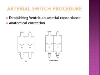  Establishing Ventriculo-arterial concordance
 Anatomical correction
 