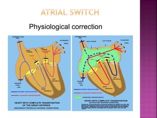 Physiological correction
 