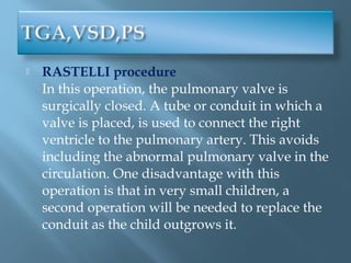 Transposition of Great Arteries;TGA,Firas Aljanadi,MD | PPT