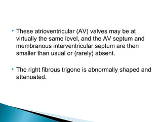  These atrioventricular (AV) valves may be at
virtually the same level, and the AV septum and
membranous interventricular septum are then
smaller than usual or (rarely) absent.
 The right fibrous trigone is abnormally shaped and
attenuated.
 