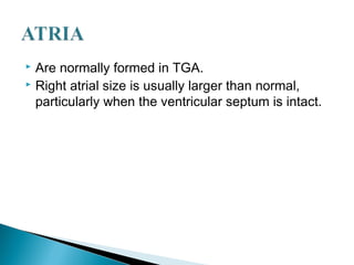  Are normally formed in TGA.
 Right atrial size is usually larger than normal,
particularly when the ventricular septum is intact.
 