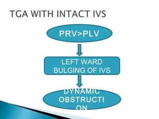 PRV>PLV
LEFT WARD
BULGING OF IVS
DYNAMIC
OBSTRUCTI
ON
 