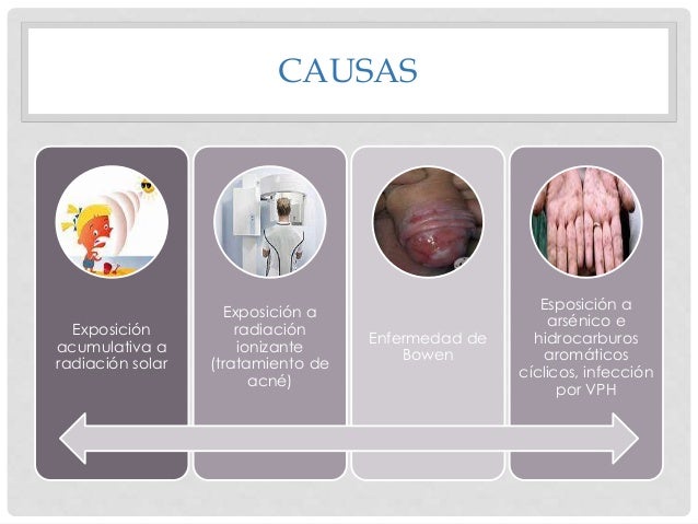 Las innovaciones en el tratamiento del acné