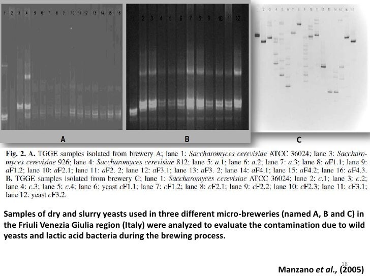 Temperature Gradient Gel Electrophoresis