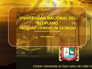 UNIVERSIDAD NACIONAL DEL
ALTIPLANO
FACULTAD CIENCIAS DE LA SALUD
Escuela Profesional de Odontología
PATOLOGIA BUCAL
 