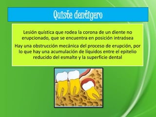 Quiste dentigero
Lesión quística que rodea la corona de un diente no
erupcionado, que se encuentra en posición intraósea
Hay una obstrucción mecánica del proceso de erupción, por
lo que hay una acumulación de líquidos entre el epitelio
reducido del esmalte y la superficie dental
 