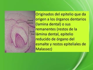 Originados del epitelio que da
origen a los órganos dentarios
(lamina dental) o sus
remanentes (restos de la
lámina dental, epitelio
reducido de órgano del
esmalte y restos epiteliales de
Malassez)
 