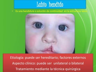 Labio hendido
Etiología: puede ser hereditario; factores externos
Aspecto clínico: puede ser unilateral o bilateral
Tratamiento mediante la técnica quirúrgica
 