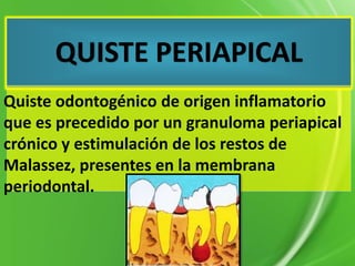QUISTE PERIAPICAL
Quiste odontogénico de origen inflamatorio
que es precedido por un granuloma periapical
crónico y estimulación de los restos de
Malassez, presentes en la membrana
periodontal.
 