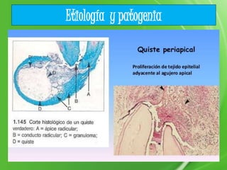 Etiología y patogenia
 