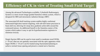 TREATMENT OF TGN WITH CYBERKNIFE FRAMELESS RADIOSURGERY SYSTEM | PPTX