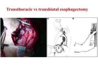 Critical care aspects of GI surgery by Professor Lars Lundell | PPTX