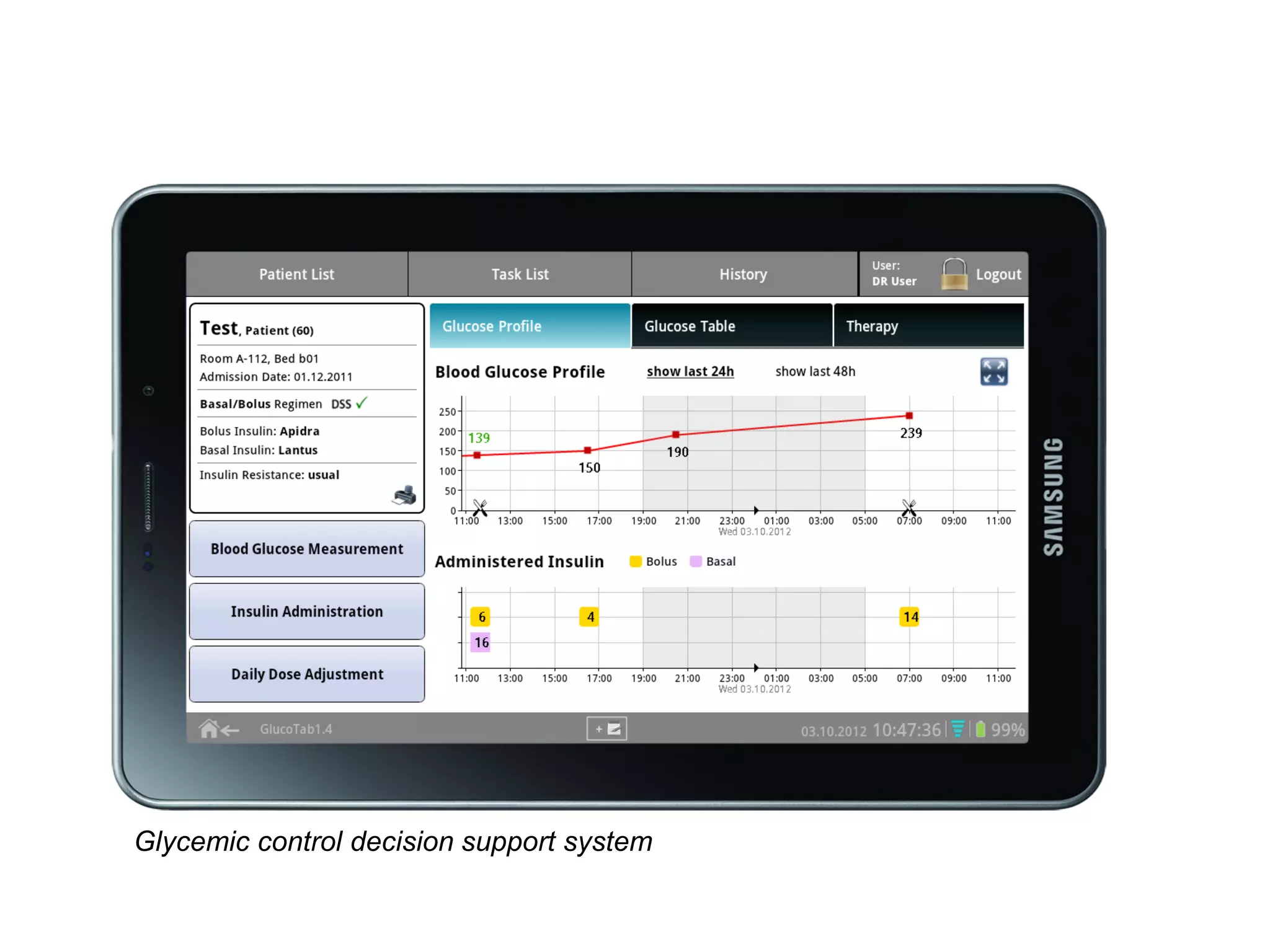 Glycemic control decision support system
 