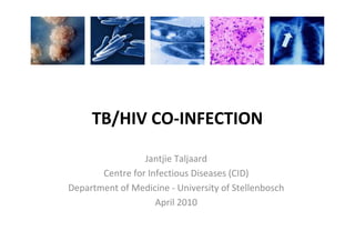 TB/HIV CO-INFECTION
Jantjie Taljaard
Centre for Infectious Diseases (CID)
Department of Medicine - University of Stellenbosch
April 2010
 