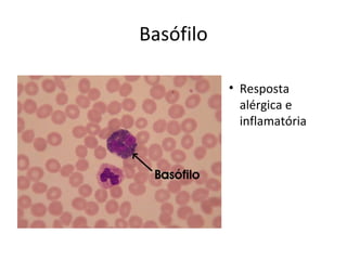 Basófilo
• Resposta
alérgica e
inflamatória
 