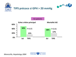 TIPS précoce si GPH > 20 mmHg 
Echec critère principal 
60% 
40% 
20% 
0% 
Mortalité J42 
50% 
38% 
12% 
17% 
Scl TIPS 
Monescillo, Hepatology 2004 
P<0.05 
Scl TIPS 
52 patients 
P<0.05 
 