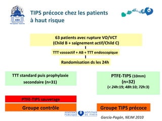TIPS précoce chez les patients 
à haut risque 
63 patients avec rupture VO/VCT 
(Child B + saignement actif/Child C) 
TTT vasoactif + AB + TTT endoscopique 
PTFE-TIPS (10mm) 
(n=32) 
Randomisation ds les 24h 
(< 24h:19; 48h:10; 72h:3) 
PTFE-TIPS sauvetage 
Groupe contrôle Groupe TIPS précoce 
García-Pagán, NEJM 2010 
 