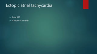 Ectopic atrial tachycardia
 Rate 120
 Abnormal P waves
 