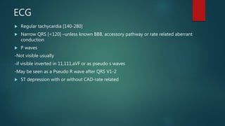 ECG
 Regular tachycardia [140-280]
 Narrow QRS [<120] –unless known BBB, accessory pathway or rate related aberrant
conduction
 P waves
-Not visible usually
-if visible inverted in 11,111,aVF or as pseudo s waves
-May be seen as a Pseudo R wave after QRS V1-2
 ST depression with or without CAD-rate related
 