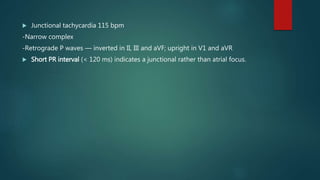  Junctional tachycardia 115 bpm
-Narrow complex
-Retrograde P waves — inverted in II, III and aVF; upright in V1 and aVR
 Short PR interval (< 120 ms) indicates a junctional rather than atrial focus.
 