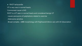  RVOT tachycardia
VT is very rare in normal hearts
Commonest cause is IHD
RVOT is a VT seen in normal hearts and considered benign VT
-causes paroxysms of palpitations related to exercise
-Adenosine sensitive
-Broad complex , LBBB morphology with Rightward/inferior axis with AV dissociation
 
