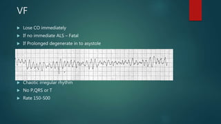 VF
 Lose CO immediately
 If no immediate ALS – Fatal
 If Prolonged degenerate in to asystole
 Chaotic irregular rhythm
 No P,QRS or T
 Rate 150-500
 