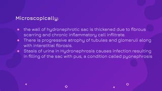Microscopically:
● the wall of hydronephrotic sac is thickened due to ﬁbrous
scarring and chronic inﬂammatory cell inﬁltrate.
● There is progressive atrophy of tubules and glomeruli along
with interstitial ﬁbrosis.
● Stasis of urine in Hydronephrosis causes infection resulting
in ﬁlling of the sac with pus, a condition called pyonephrosis
 