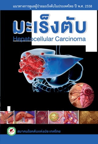 สมาคมโรคตับเเห‹งประเทศไทย
สมาคมโรคตับเเห‹งประเทศไทย
มะเร็งตับHepatocellular Carcinoma
แนวทางการดูแลผูปวยมะเร็งตับในประเทศไทย ป พ.ศ. 2558
7 8 6 1 6 99 1 3 0 8 3 3
 