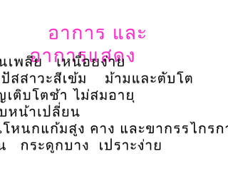 อาการ และ
อาการแสดงนเพลีย เหนื่อยง่าย
ปัสสาวะสีเข้ม ม้ามและตับโต
ญเติบโตช้า ไม่สมอายุ
บหน้าเปลี่ยน
นโหนกแก้มสูง คาง และขากรรไกรกว
น กระดูกบาง เปราะง่าย
 
