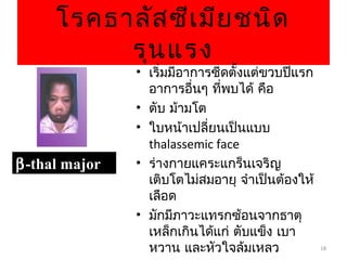 18
โรคธาลัสซีเมียชนิด
รุนแรง
ββ-thal major-thal major
• เริ่มมีอาการซีดตั้งแต่ขวบปีแรก
อาการอื่นๆ ที่พบได้ คือ
• ตับ ม้ามโต
• ใบหน้าเปลี่ยนเป็นแบบ
thalassemic face
• ร่างกายแคระแกร็นเจริญ
เติบโตไม่สมอายุ จำาเป็นต้องให้
เลือด
• มักมีภาวะแทรกซ้อนจากธาตุ
เหล็กเกินได้แก่ ตับแข็ง เบา
หวาน และหัวใจล้มเหลว
 