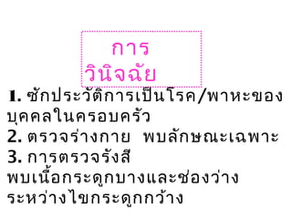 การ
วินิจฉัย
1. ซักประวัติการเป็นโรค/พาหะของ
บุคคลในครอบครัว
2. ตรวจร่างกาย พบลักษณะเฉพาะ
3. การตรวจรังสี
พบเนื้อกระดูกบางและช่องว่าง
ระหว่างไขกระดูกกว้าง
 