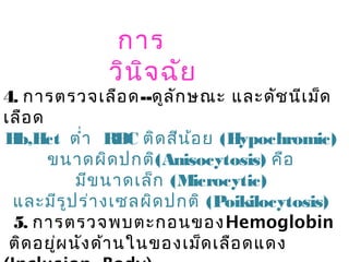 4. การตรวจเลือด--ดูลักษณะ และดัชนีเม็ด
เลือด
Hb,Hct ตำ่า RBC ติดสีน้อย (Hypochromic)
ขนาดผิดปกติ(Anisocytosis) คือ
มีขนาดเล็ก (Microcytic)
และมีรูปร่างเซลผิดปกติ (Poikilocytosis)
5. การตรวจพบตะกอนของHemoglobin
ติดอยู่ผนังด้านในของเม็ดเลือดแดง
การ
วินิจฉัย
 