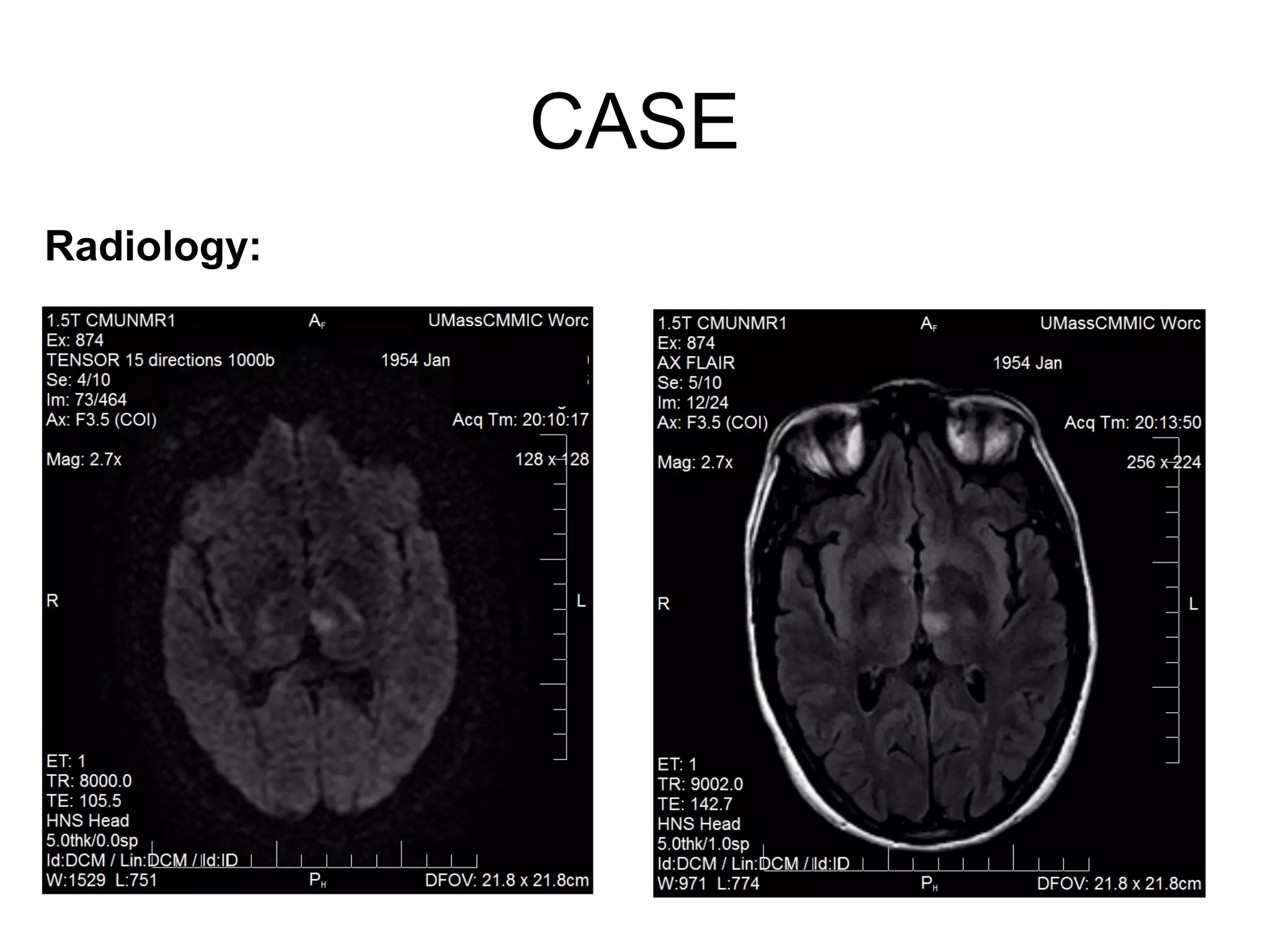 CASE
Radiology:
 