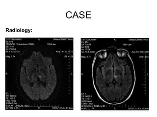 CASE
Radiology:
 