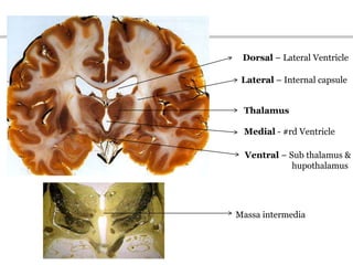 Massa intermedia
Medial - #rd Ventricle
Dorsal – Lateral Ventricle
Lateral – Internal capsule
Thalamus
Ventral – Sub thalamus &
hupothalamus
 