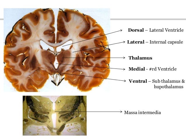 thalamus