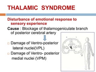 THALAMIC SYNDROME
Disturbance of emotional response to
sensory experience
Cause : Blockage of thalamogeniculate branch
of posterior cerebral artery
 Damage of Ventro-posterior
lateral nuclei(VPL)
 Damage of Ventro- posterior
medial nuclei (VPM)
 