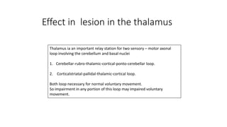 Thalamus ia an important relay station for two sensory – motor axonal
loop involving the cerebellum and basal nuclei
1. Cerebellar-rubro-thalamic-cortical-ponto-cerebellar loop.
2. Corticalstriatal-pallidal-thalamic-cortical loop.
Both loop necessary for normal voluntary movement.
So impairment in any portion of this loop may impaired voluntary
movement.
Effect in lesion in the thalamus
 