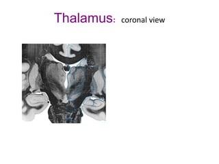 Thalamus: coronal view
 